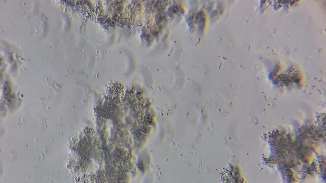 Microscopic view of lactic acid bacteria and casein matrix in cottage cheese