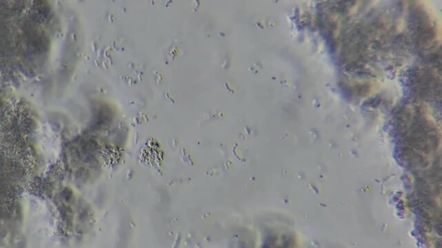 Microscopic view of lactic acid bacteria and casein matrix in cottage cheese