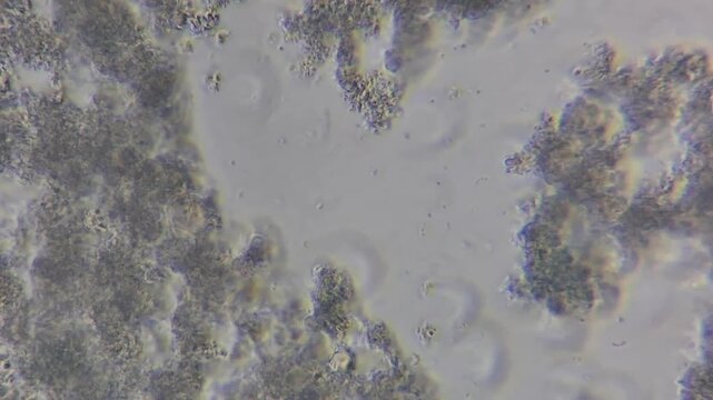Microscopic view of lactic acid bacteria and casein matrix in cottage cheese