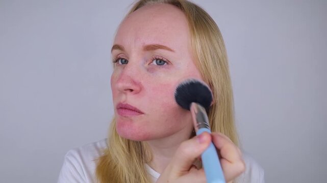 Blonde woman applying face powder to conceal skin redness, rosacea symptoms, or sunburn. Girl covering up damaged, irritated skin with cosmetic makeup brush.