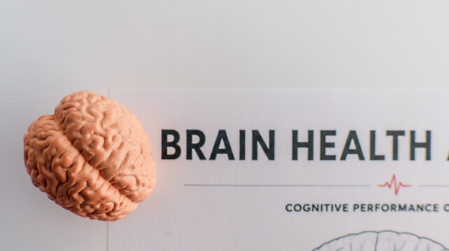 Model of a human brain next to a document about brain health and cognitive performance