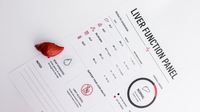 Liver function test results with a small model of the organ on a white background