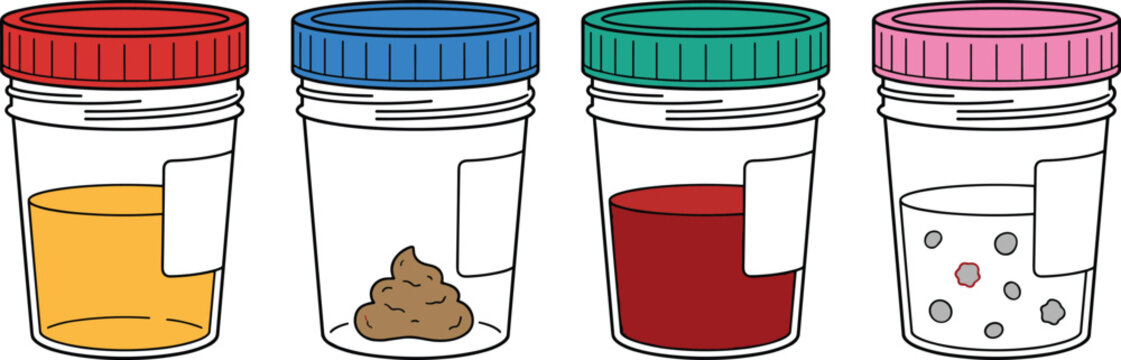 Medical laboratory specimen cups collection containing urine stool blood and semen samples for clinical diagnostic test vector illustration