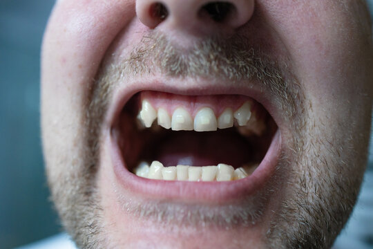 Open mouth smiling, in indoor, with teeth, mustache, with skin, hair texture, from a close-up perspective, with white, pink accents, and happy mood, with clear light and balanced composition.