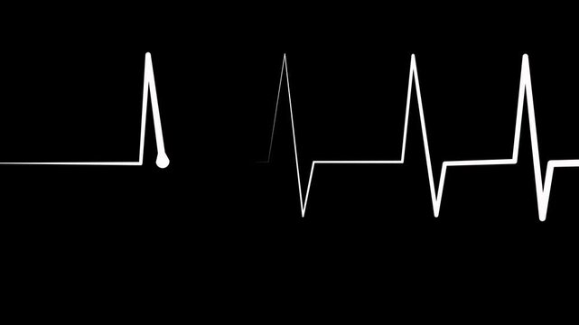 Ecg heart rhythm line on graph paper showing pulse spikes and flat line animation