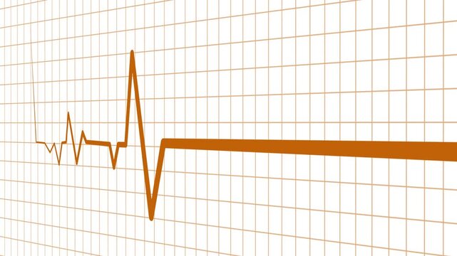 Heart beat line on graph paper showing an ecg pattern and medical signal animation
