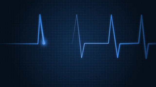 Ecg heart rhythm line on graph paper showing pulse spikes and flat line animation