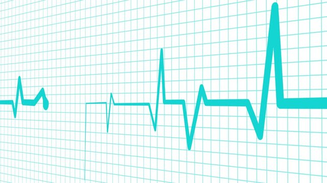 Heartbeat line irregular electrocardiogram pattern animation