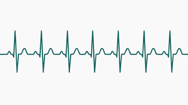 Heartbeat monitor line for medical concept.