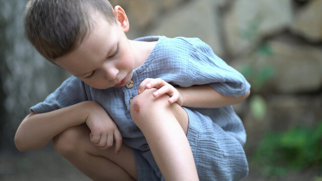 Young boy blows on his injured knee and touches the scrape outdoors. Concerned expression while trying to soothe the pain in soft natural light.