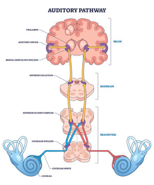 Auditory pathway outline shows sound traveling from cochlea through cochlear nerve and brainstem to auditory cortex, key elements, cochlea, brainstem, cortex. Outline diagram