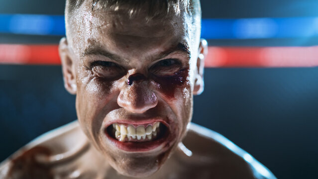 MMA Fighters Face Off in a Brutal Fight Inside the Cage as a Bloodied Fighter Snarls at the Camera, Showing Hard Contact, Competitive Championship Title Show Bout of Martial Arts Action.