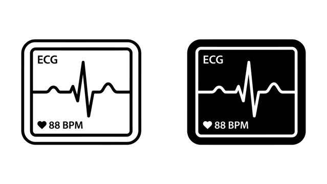 ECG Monitor Display: Two digital displays show an electrocardiogram (ECG) reading with a heart rate of 88 BPM, one in outline and one in black.