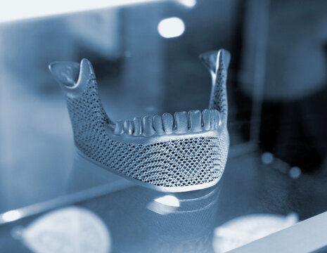 Object custom jaw printed on 3D printer from titanium. Model lower jaw printed 3D printer from metal powder. Selective Laser Melting. SLM. Additive new modern manufacturing. 3D printing technology