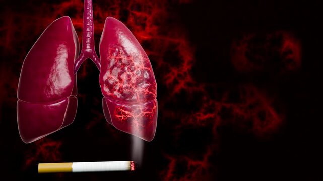 Human lung damage by a cigarette embedded into diseased lungs, showing how smoking leads to cancer, emphysema, COPD, respiratory failure, and life-shortening conditions linked tobacco. 3d rendering 
