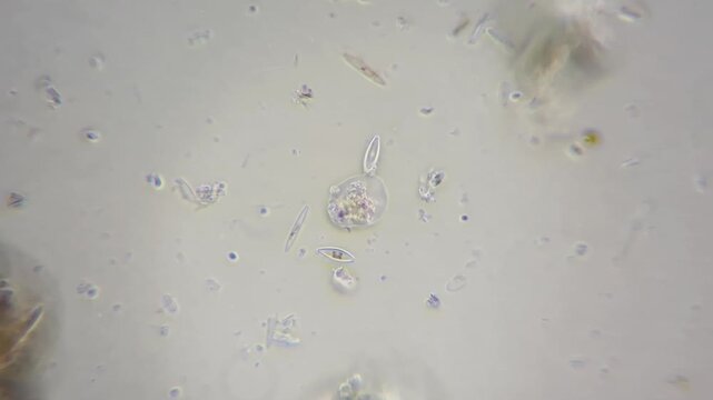 Microscopic timelapse of Amoeba feeding on diatoms in freshwater pond drop, 4k