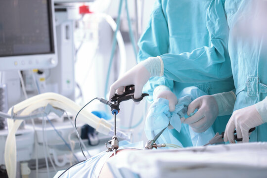 Surgeons perform laparoscopic surgery. Modern abdominal surgery. Surgical intervention through small holes. Penetration into abdominal cavity. Team of surgeons