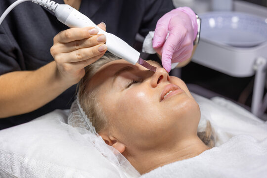 Professional cosmetologist uses an ultrasonic skin scrubber to gently exfoliate and cleanse facial skin, improving texture and promoting a smoother, healthier complexion.