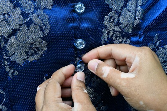 A woman's hands fastening the buttons on a brocade garment.