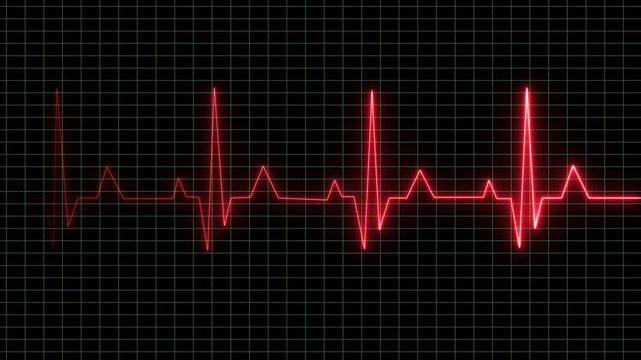 Heartbeat monitor displays a rhythmic red pulse wave across a digital medical grid background to signify vital sign monitoring and cardiac health tracking for patients in a clinical hospital setting.