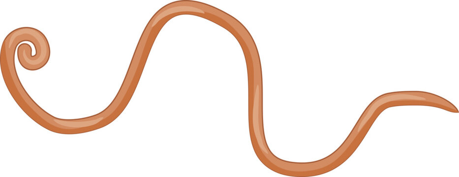 Ascariasis
