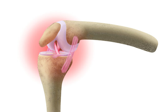 Anatomy of healthy knee joint showing  femur, tibia ,patella, meniscus and ligaments for medical background. 