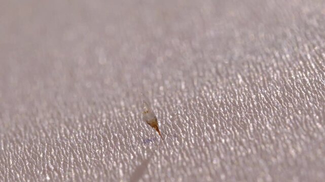 Honey Bee Stinging Human Skin with Visible Stinger Close Up Macro