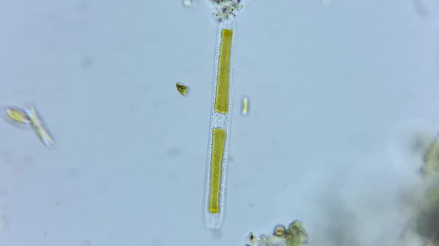 Microscopic view of a freshwater diatom pinnularia algae under light microscope