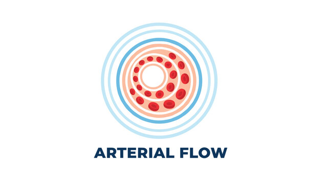 Cross section diagram of a blood vessel demonstrating arterial flow with red blood cells moving through the artery.