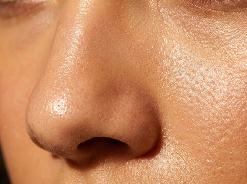 Close up of oily skin showing sebum shine and texture details, highlighting skin imperfections