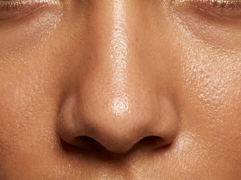 Closeup of oily skin showing sebum shine and texture on nose area, highlighting skin details