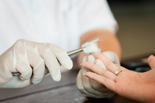 Tactile close up of healthcare professional in medical gloves using forceps with sterile cotton ball to sanitize patient fingertip for diabetes testing