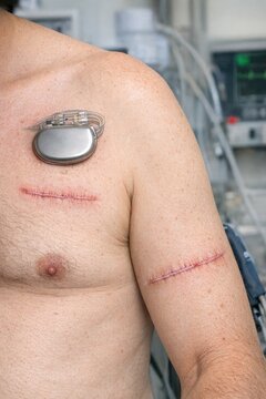 A person suffering from an injury on their chest with possible implications of violence or medical attention