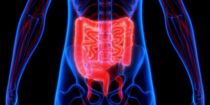 Visualizing the intricate internal structure of the human digestive system, prominently featuring the inflamed large intestine and surrounding vascular network within a stylized anatomical