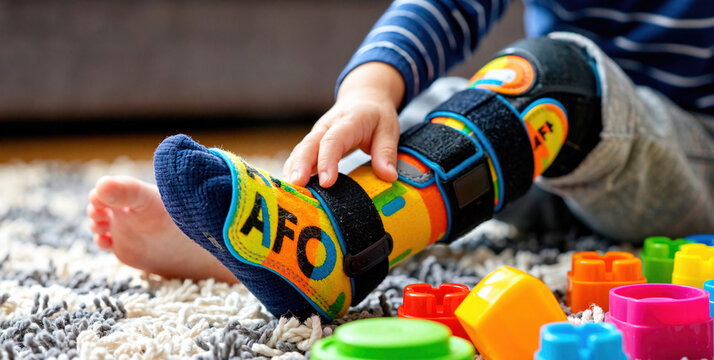 Colorful Ankle-Foot Orthosis on Child's Leg Amidst Playful Environment