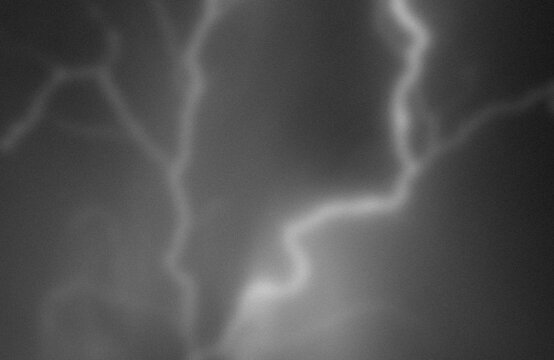 Fluoroscopy image showing contrast in the esophagus