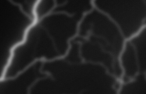 Angiographic imaging of cerebral blood vessels and arterial structure