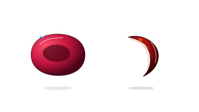Medical illustration of normal and sickle blood cells