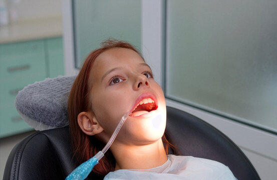 Little girl with open mouth using saliva ejector in dental chair close up.