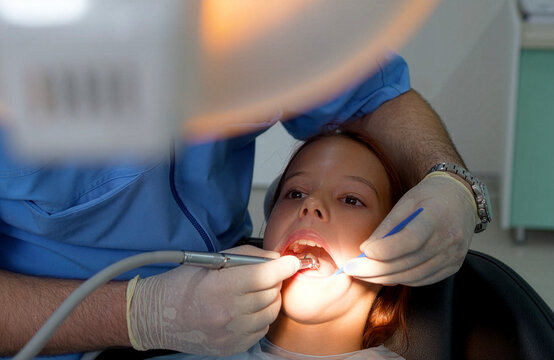 Dentist drilling little girl tooth with high speed handpiece under lamp close up