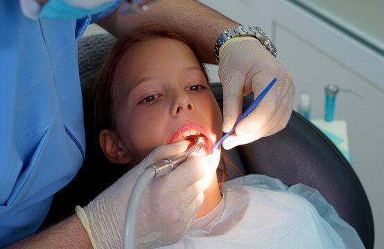 Dentist placing cotton roll in little girl mouth with tweezers during treatment.