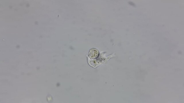 Real footage of live amoeba moving under light microscope 