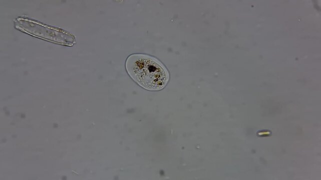 Real footage of live amoeba moving under light microscope 
