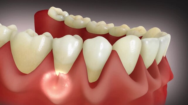 Healing molecules treating the receding gums, gingivitis etc.