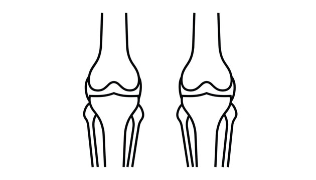Anatomical outline illustration of human knee joints showing bones of the lower leg on white background.