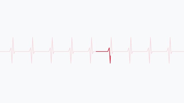 Ekg heartbeat monitor line animation on 4k white background, for medical healthcare, concept heart rate