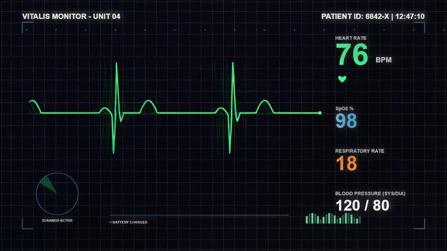 Medical Vital Signs Monitor Displaying Patient Heart Rate and ECG