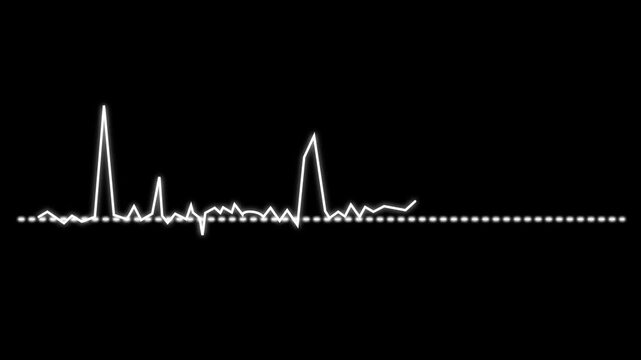 Chaotic signal waveform animation with white and yellow lines fading out along dotted axis on black background.