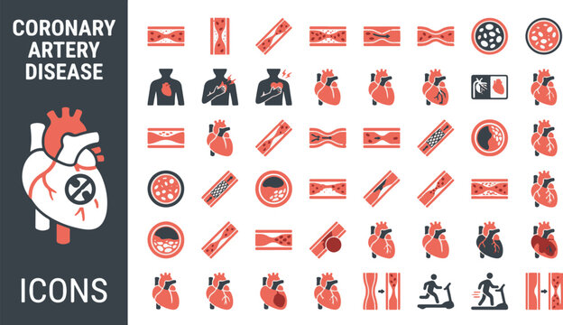Coronary artery disease medical icon set with heart health, atherosclerosis stages, angina symptoms, cardiac stent surgery, blood flow occlusion, plaque buildup, and cardiology illustrations.