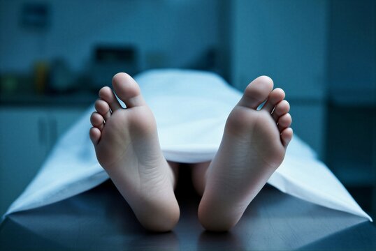 The corpse, the body of a deceased man, covered with a white sheet on a metal autopsy table of a pathologist in a morgue.